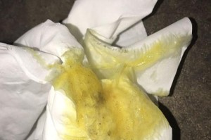 狗狗细小病毒的潜伏期究竟有多久？（探究狗狗感染细小病毒后发病前的潜伏期长度及其关键影响因素）