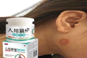 猫皮肤病的治疗药物推荐（选择合适的药物，让你的猫摆脱皮肤病困扰）