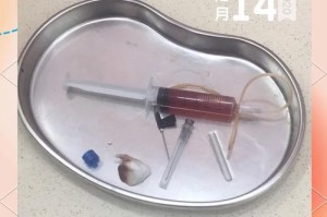 狗狗耳血肿的治疗方法介绍（了解耳血肿的成因和治疗手段，保护宠物的听力健康）