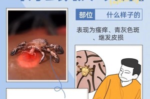 揭秘俩月狗狗肚子有虫的症状（了解宠物犬的常见寄生虫症状，保障狗狗健康）