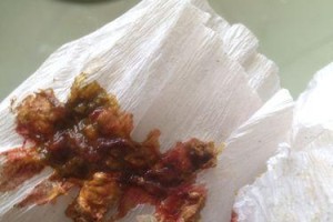 狗狗大便中褐色晶体的原因及解决方法（了解狗狗大便中褐色晶体的成因和处理方式，守护它们的健康）