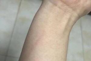 以犬打20的症状及预防措施（了解狂犬病的主要症状，保护你和你的宠物）