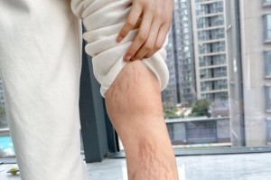 牛肥胖的危害与相关疾病（了解牛肥胖如何导致疾病的关键）