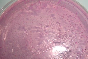 细菌的生存能力（揭秘细菌的生存之道和寿命长短）