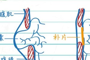 犬腹壁疝（了解犬腹壁疝，预防并发症）
