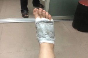 以脚抖的原因分析（探索脚抖的病因与解决办法）