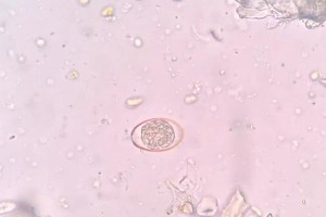 兔球虫卵的孵化时间及影响因素研究（探究兔球虫卵孵化时间的关键因素及应用前景）